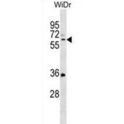 Multimerin 1 (MMRN1) Antibody