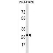 Voltage-Dependent Anion-Selective Channel Protein 3 (VDAC3) Antibody