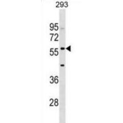 Interferon Induced Protein With Tetratricopeptide Repeats 2 (IFIT2) Antibody