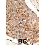 Bone Morphogenetic Protein 10 (BMP10) Antibody