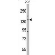 DExH-Box Helicase 30 (DHX30) Antibody