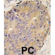 Bone Morphogenetic Protein 15 (BMP15) Antibody