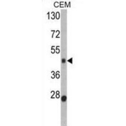 Bone Morphogenetic Protein 15 (BMP15) Antibody