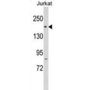 RNA Polymerase II Associated Protein 1 (RPAP1) Antibody