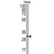 Quinone Oxidoreductase-Like Protein 1 (CRYZL1) Antibody