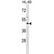 abx029315