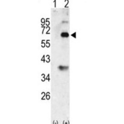 Bone Morphogenetic Protein 3 (Bmp3) Antibody