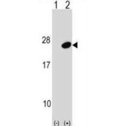 Ubiquitin-Conjugating Enzyme E2 G1 (UBE2G1) Antibody