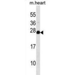 Nucleoside Diphosphate-Linked Moiety X Motif 4 (NUDT4) Antibody