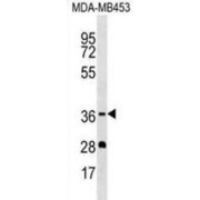 Olfactory Receptor Family 5 Subfamily M Member 1 (OR5M1) Antibody
