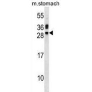 Troponin I, Cardiac Muscle (TNNI3) Antibody
