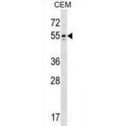 Potassium Voltage-Gated Channel Subfamily A Member 6 (KCNA6) Antibody