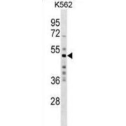 RING Finger Protein 62 (MKRN2) Antibody