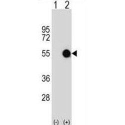 RING Finger Protein 62 (MKRN2) Antibody