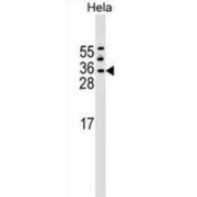 Histone Chaperone ASF1A (ASF1A) Antibody