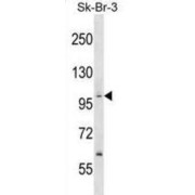 Apoptosis-Stimulating of P53 Protein 1 (PPP1R13B) Antibody