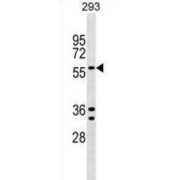 abx029363