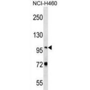 Nuclear Valosin-Containing Protein-Like (NVL) Antibody