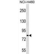 Praja Ring Finger Ubiquitin Ligase 2 (PJA2) Antibody