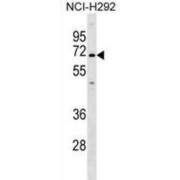 Potassium Intermediate Small Conductance Calcium Activated Channel Subfamily N, Member 1 (KCNN1) Antibody