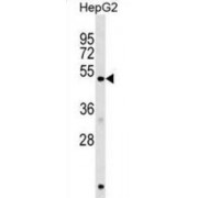 Homocysteine Inducible Endoplasmic Reticulum Stress Inducible Ubiquitin Like Domain Member 1 (HERPUD1) Antibody