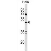 Alpha-1,3/1,6-Mannosyltransferase ALG2 (ALG2) Antibody