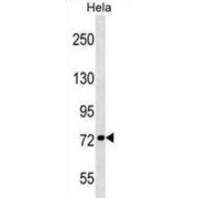 Kinesin-Like Protein KIF3B (KIF3B) Antibody