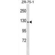 Phosphatidylinositol Transfer Protein Membrane Associated 1 (PITPNM1) Antibody