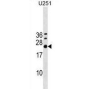 Exosome Component 4 (EXOSC4) Antibody
