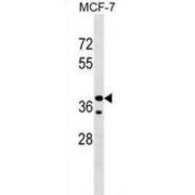 Collagen And Calcium-Binding EGF Domain-Containing Protein 1 (CCBE1) Antibody