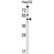 Malonyl-CoA-Acyl Carrier Protein Transacylase, Mitochondrial (MCAT) Antibody