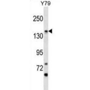 Phosphatidylinositol Glycan Anchor Biosynthesis Class O (PIGO) Antibody