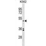 Uronyl 2-Sulfotransferase (UST) Antibody
