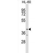 Ankyrin Repeat And BTB/POZ Domain Containing Protein 1 (ABTB1) Antibody