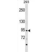 Zinc Finger Protein 341 (ZNF341) Antibody