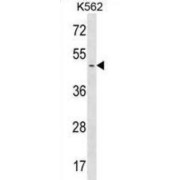 Protein Phosphatase Methylesterase 1 (PPME1) Antibody