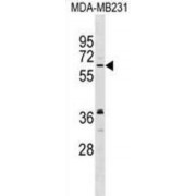 Negative Elongation Factor Complex Member E (NELF) Antibody