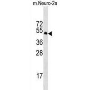 STE20/SPS1-Related Proline-Alanine-Rich Protein Kinase (Stk39) Antibody