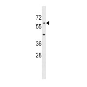 Acyloxyacyl Hydrolase (AOAH) Antibody