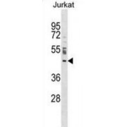 Nucleoporin Nup43 (NUP43) Antibody