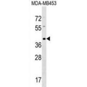 abx029462