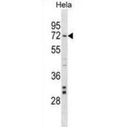 Nuclear Prelamin A Recognition Factor (NARF) Antibody