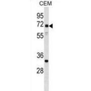 NPL4 Homolog, Ubiquitin Recognition Factor (NPLOC4) Antibody