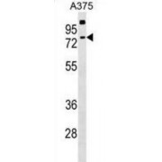Transketolase-Like Protein 2 (TKTL2) Antibody