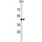Tumor Necrosis Factor Receptor Superfamily, Member 25 (TNFRSF25) Antibody