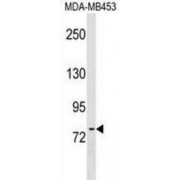 Protein-O-Mannosyltransferase 2 (POMT2) Antibody