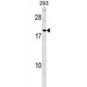 Hepatoma Derived Growth Factor-Related Protein 3 (HDGFRP3) Antibody