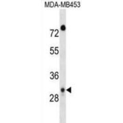 Dual Adaptor of Phosphotyrosine And 3-Phosphoinositides 1 (DAPP1) Antibody