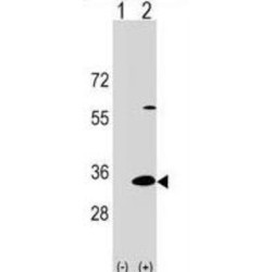 Dual Adaptor of Phosphotyrosine And 3-Phosphoinositides 1 (DAPP1) Antibody