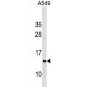 Cytochrome C Oxidase Subunit 5B (COX5B) Antibody